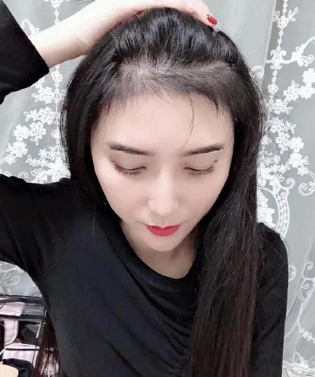  #越高的发际#不想被人叫大长脸，女生发际线高真的没办法吗？