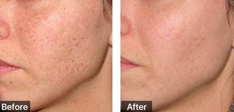 佟大为关悦“老夫老妻”霸屏综艺，演技开挂甜腻如初恋!