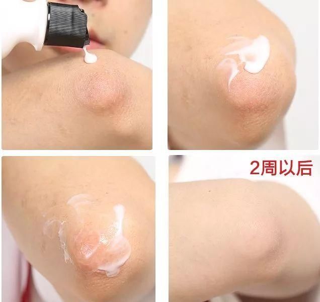 女人身上最需要保养的部位，90%女人竟都忽略了