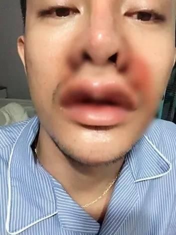 丑男整容后变帅哥，吸引众多女粉，得知原先面貌粉丝称不敢相信