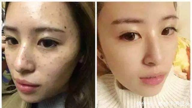  [美白淡斑]啤酒里添点“它”敷脸，坚持7天美白又淡斑，解决了很多人的烦恼