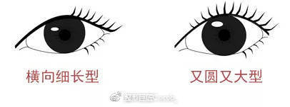 平行和扇形双眼皮该怎么选择？哪个更流行？