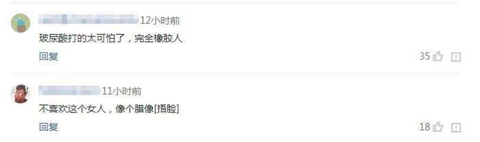 42岁金巧巧素颜现身, 网友: 一脸玻尿酸太可怕, 完全一个橡胶人