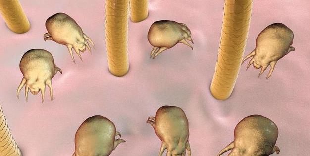  不除■脸上出油有螨虫坑坑洼洼, 不除螨, 脸注定是你的自卑