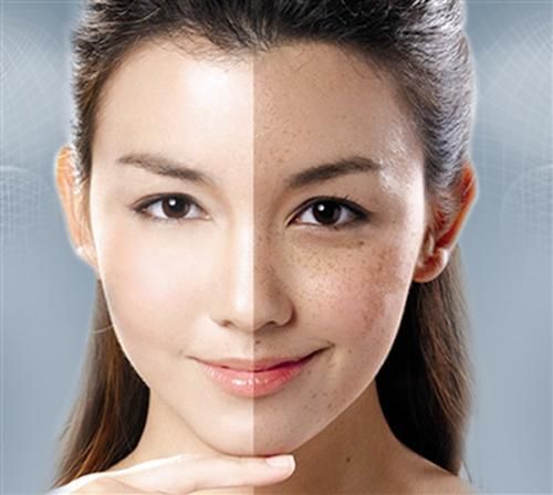 老中医翻遍医学书，用“它”一抹，斑点一扫而光，肌肤又白又亮