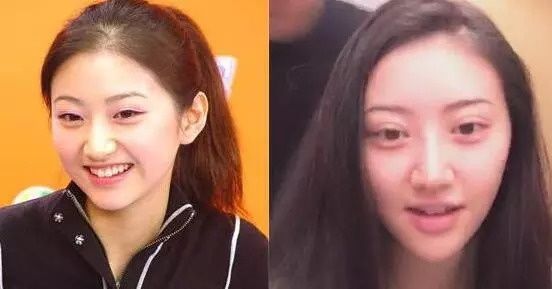 双眼皮“黄金不败宽度”来了!某璐要是早看到也不至于割完眼皮又