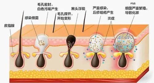  「款洗发」3款容易“踩雷”的洗发水，用后头痒又起头皮屑，没用过真的幸运