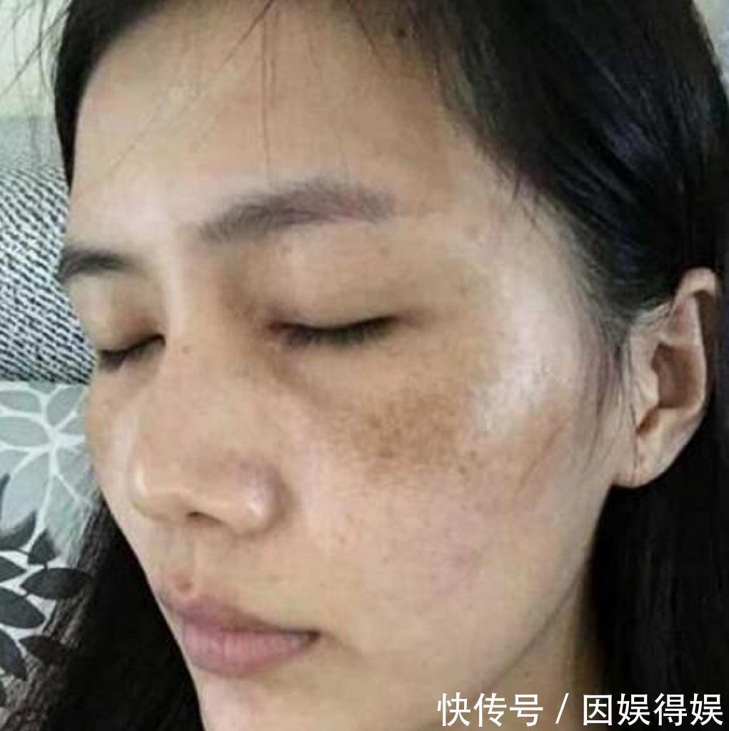  『天美』“小苏打”这样用，7天美白嫩肤，20天明显淡斑，色斑妹子不愁了
