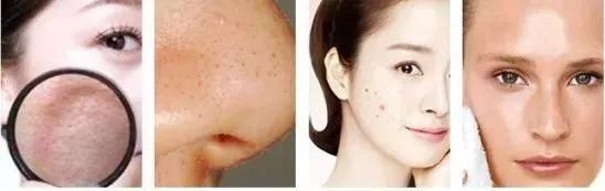 张韶涵又双叒叕种草了!10秒洗出角质、死皮，温和去角质...