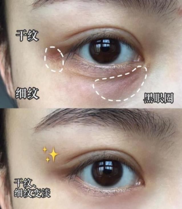 『眼霜』女人过了35,建议每天搽这种小软膏,轻松去眼袋皱纹!平价好用!