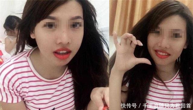 漂亮:从丑女变成漂亮女神,嫁给了富二代,21岁丑女花费10万元整容