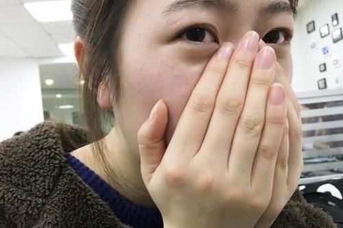  [白色小颗粒]鼻子上总是挤出白色颗粒物，是啥东西？有什么妙招可以清除干净？