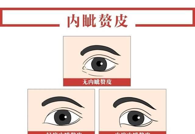 「手术」眼部整形美容——眼周配搭重构,解救四种眼周难题!