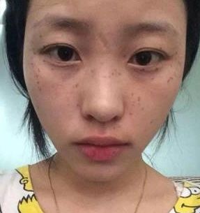 86岁老太太常用白醋加它泡一泡，七天不到肌肤嫩嫩到揪出水