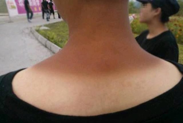 把食盐和白醋泡在一起太厉害了，解决了女人们的苦恼，效果太神奇