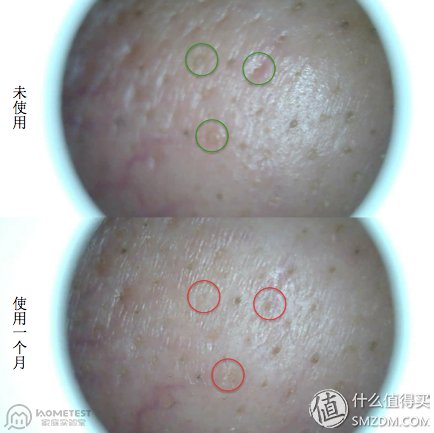 热门美容仪逐点评，真正值得投资的产品是哪个?