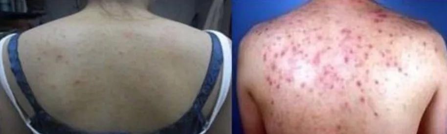 “水蜜桃”吊带背心，永久抗菌，超强排汗，运动时必须来一件