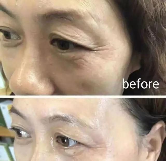  【保养】别管男女,如果脖子出现这种情况,该注意保养啦,别总是不当回事