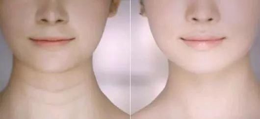 怎样才能让乳房变大？怎样才能令皮肤变好？要避开这些误区