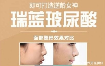  『尿酸』润蓝玻尿酸价格是多少