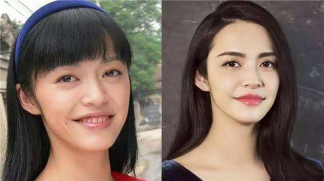  『脸上』有这3个“特征”的女生,不要留“刘海”,不仅拉低颜值还显脸大
