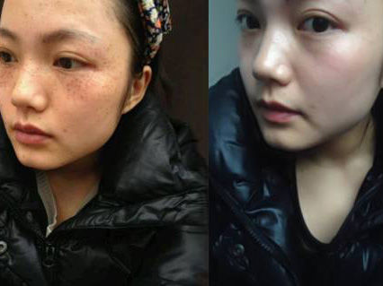 48岁小姨子偷偷说，药店一白菜价药膏，抹一点，色斑、皱纹全消