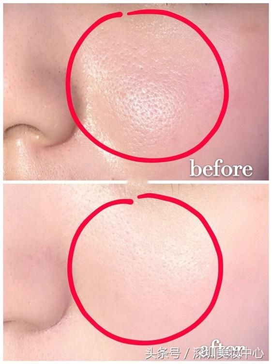 熬夜党零毛孔教程:拒绝黑头，拒绝毛孔粗大!