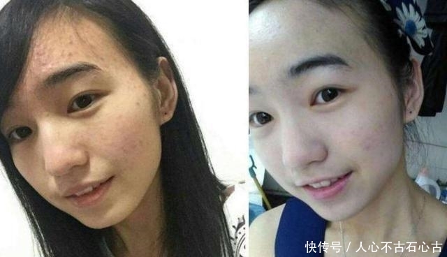 #白淡斑#丝瓜汁里加上它,15天美白淡斑明显,20天恢复肌肤白净,实力见效