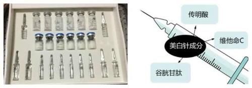 『大S』大S推荐的美白针,真的那么神奇吗?有没有副作用?