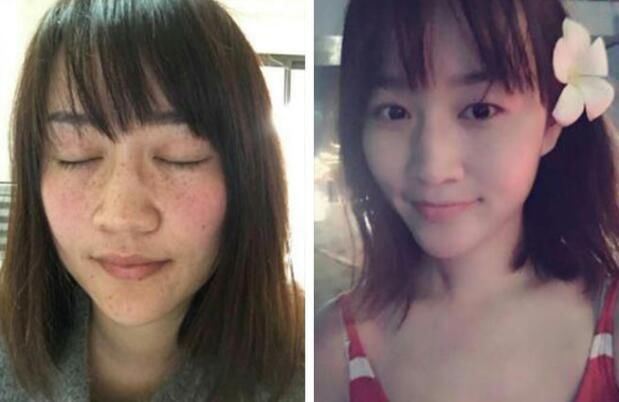 她为何一夜之间斑点全无?姐姐斑点都没有了,只有我们了