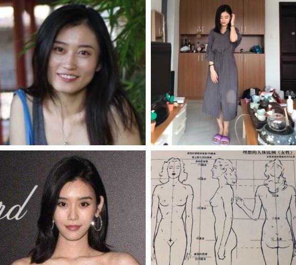 「衰老问题」素人整形分析 | 做对这些,宽方脸比瓜子脸更有优势