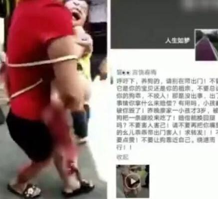 3岁小孩被狗咬掉腿？造谣的人，人血馒头好吃吗？！