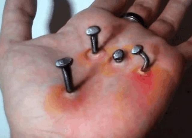 男子被钉子扎破了手，朋友们表示同情，知道真相后表示敬佩