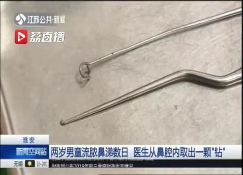  鼻腔@当心异物！淮安一两岁男童流脓鼻涕数日 医生从鼻腔内取出