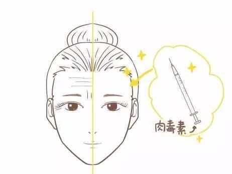  『解决』弹弹弹，弹不走的鱼尾纹，如何解决？