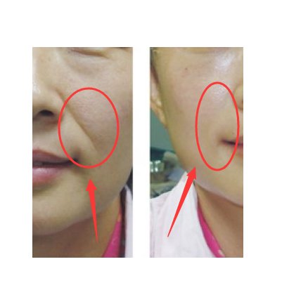 很少人知道这些护肤品，尤其是第二个，号称“皱纹克星”