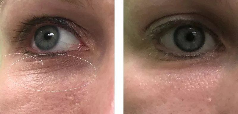 在闻风丧胆的“照妖镜”下同台battle，为什么高圆圆放肆大笑也不