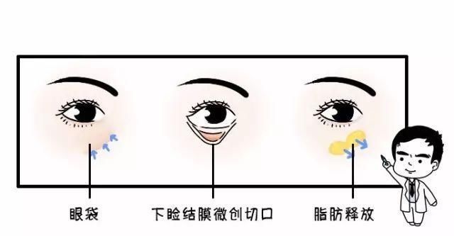  [熬夜]明明说好一起熬夜的，为什么就只有你熬出了眼袋+黑眼圈？