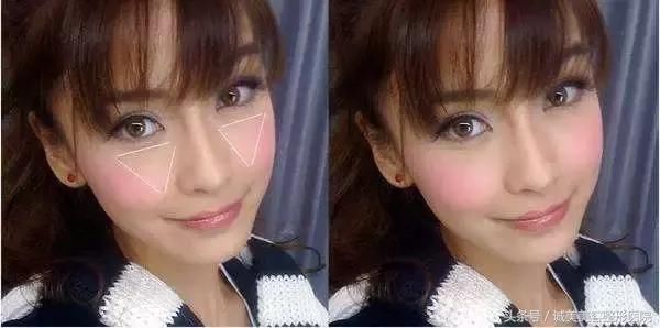 苹果肌和高颧骨之间有超大区别，你分得清楚吗？