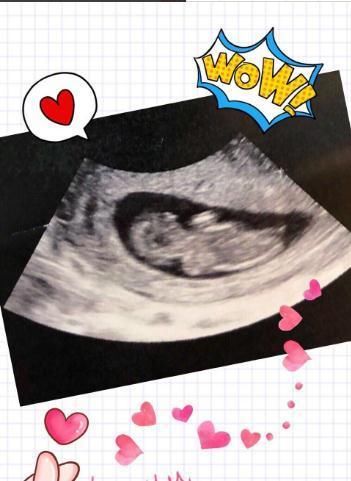 实锤怀孕消息震惊娱乐圈!这个不愿给丈夫生孩子的模特居然是等这