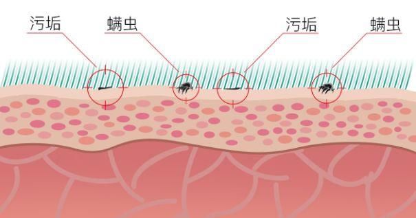 轻轻一刷，螨虫、痘痘黑头去无踪，还你光滑透亮好皮肤!