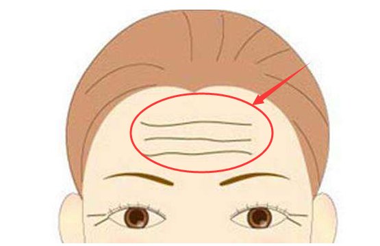 女人脸上最显老的4道皱纹，长全就变老奶奶了，学下面女人这样做