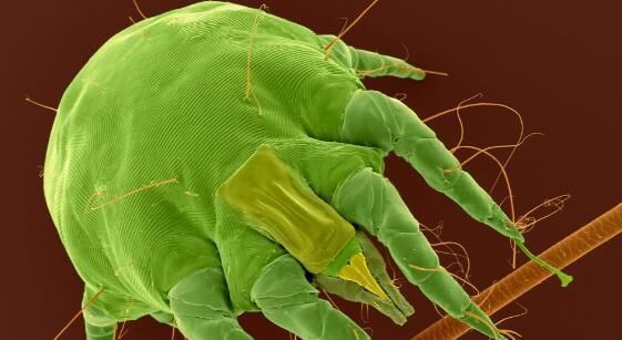 脸上有没有螨虫？抓住这4个信号后，来用3招把螨虫“连根拔起”