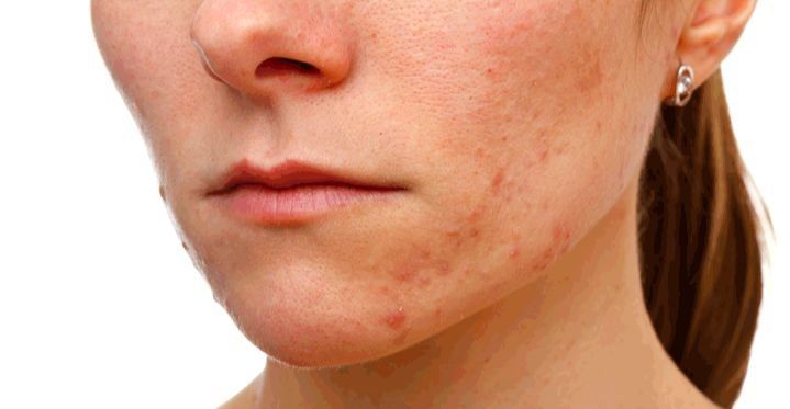 15岁金马影后“撞脸”周迅，首演网剧便斩获王俊凯荧幕初吻!