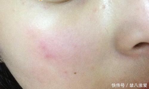 【工作】日常护肤,护肤品要不要经常换?终于知道了!再也不会浪费钱了!