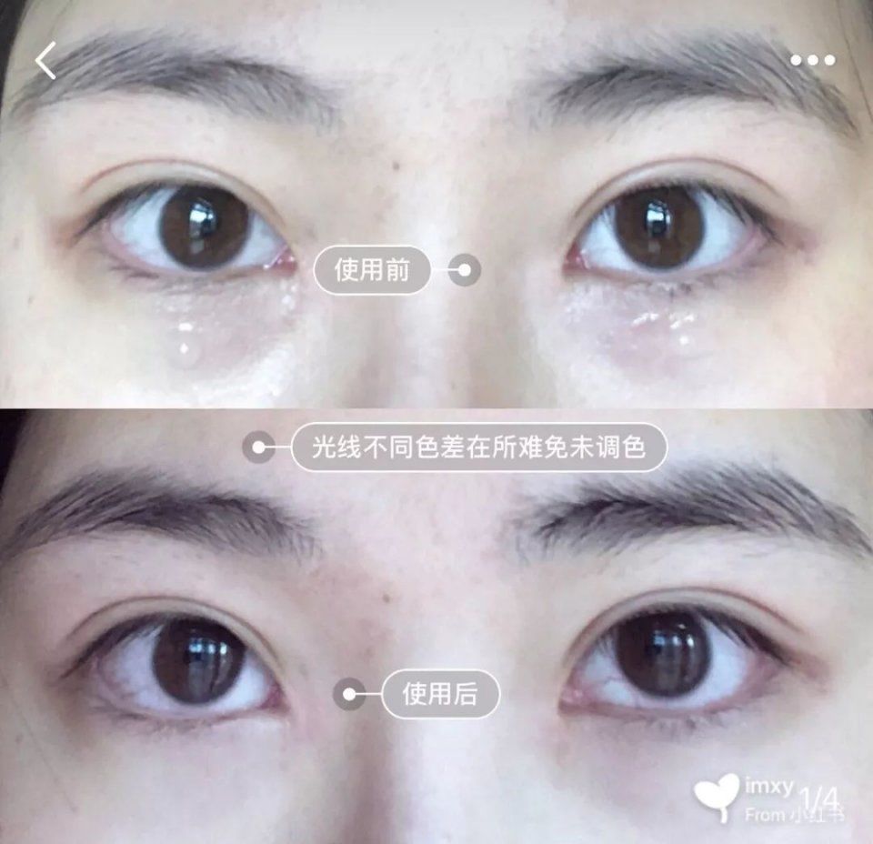 用了10多款眼霜，这支能去细纹还不长脂肪粒，我一次囤10支!