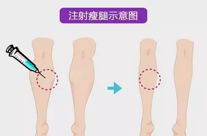 「女生」女生上半身瘦但腿粗是一种怎样的体验?腿粗女生的痛你不懂!
