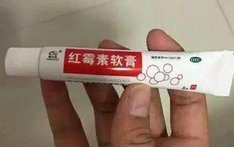 红霉素软膏不能祛斑。白醋+它抹脸，三次美白，祛斑强过激光30倍