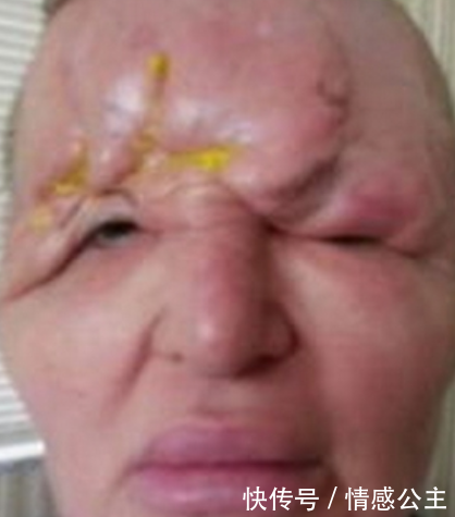 40岁的女人不顾反对，坚持整容，手术失败后丈夫的做法令人意外