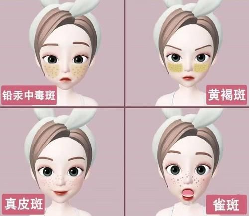  预防：脸上的斑点是如何形成的？看看这4种你有没有，最后一种可预防